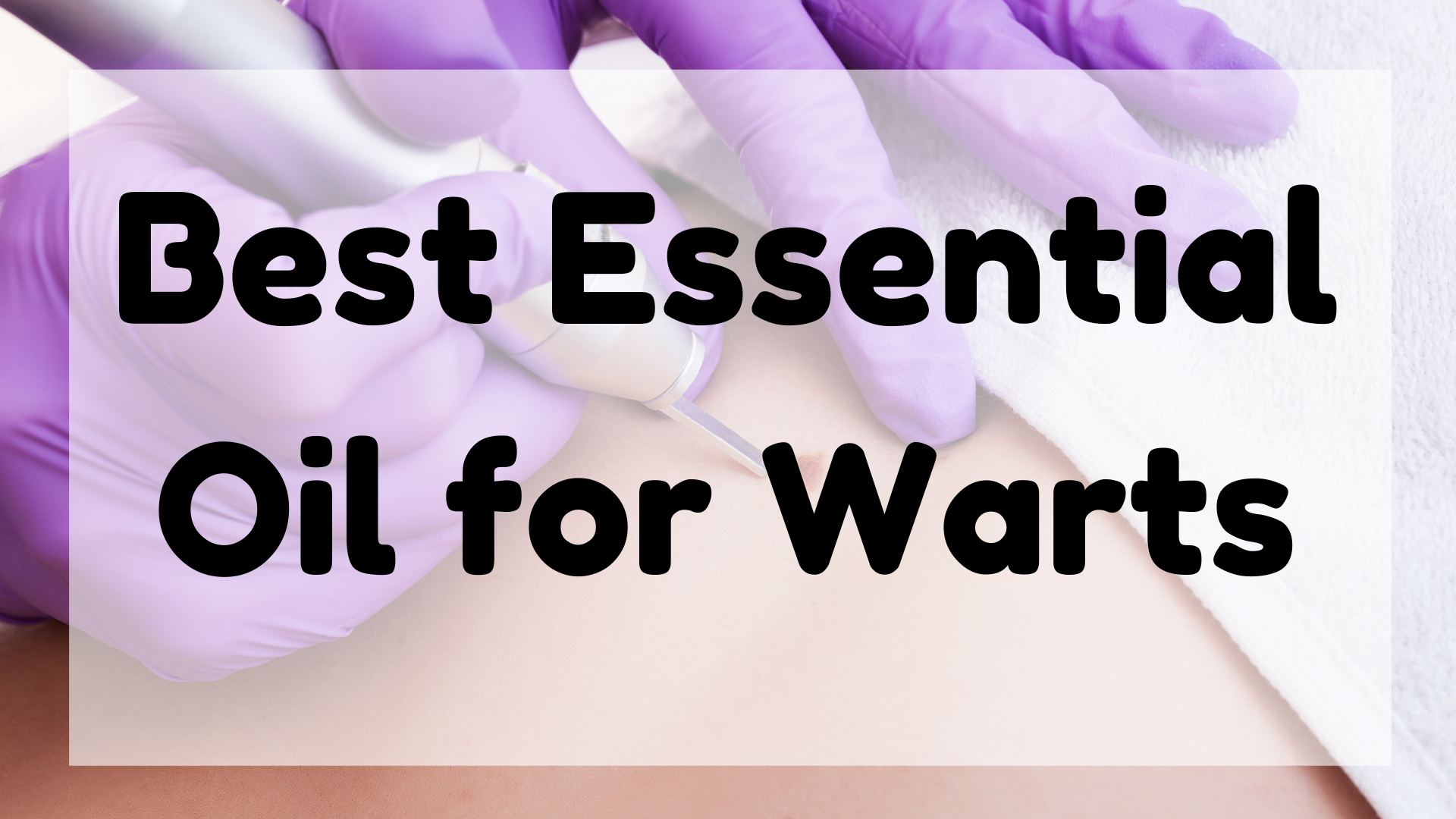 Best Essential Oil For Warts