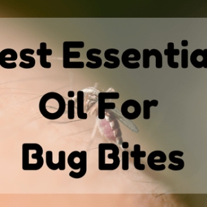 Best Essential Oil for Bug Bites