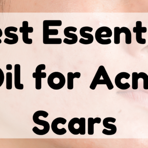 Essential Oil For Acne Scars