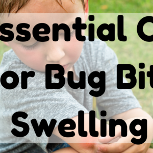 Essential Oil For Bug Bite Swelling