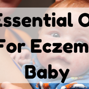 Essential Oil For Eczema Baby