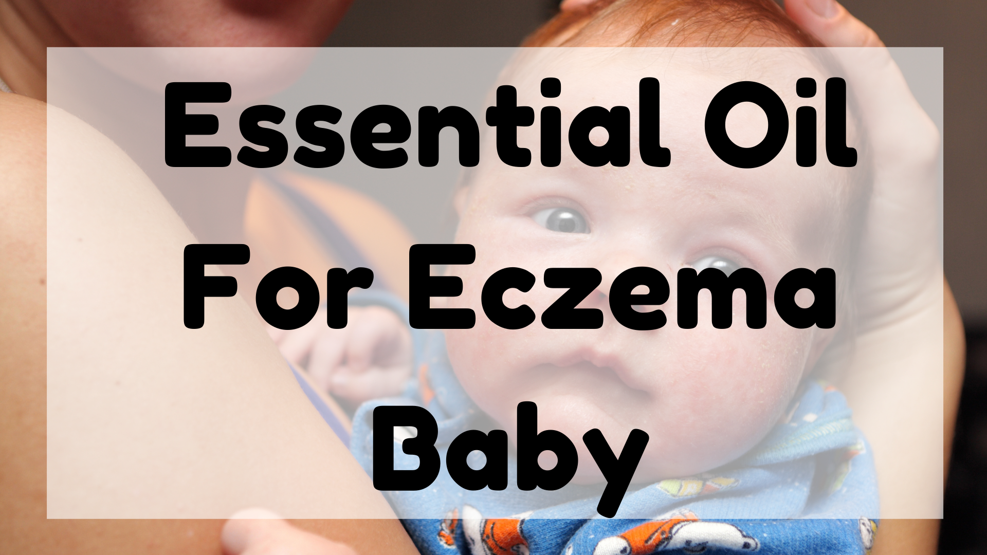Essential Oil For Eczema Baby