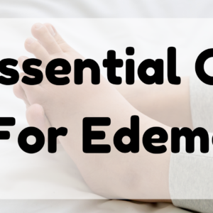 Essential Oil For Edema
