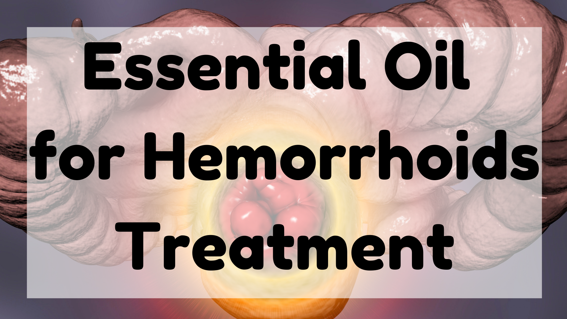 Essential Oil For Hemorrhoids Treatment
