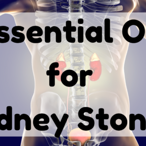 Essential Oil For Kidney Stones