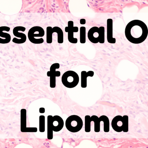Essential Oil For Lipoma