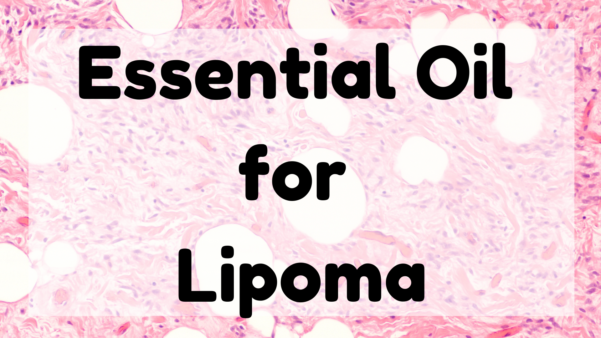 Essential Oil For Lipoma