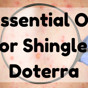 Essential Oil For Shingles - Doterra