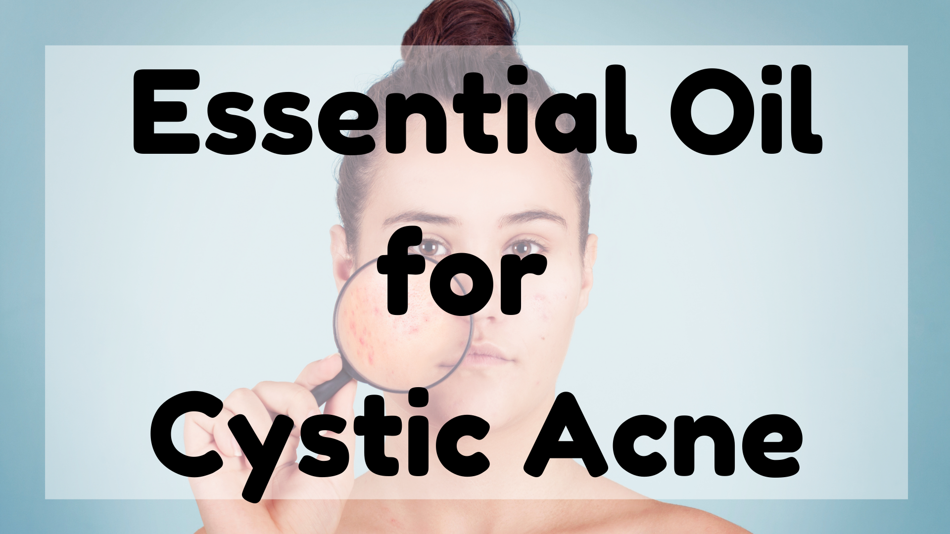 Essential Oil For Cystic Acne