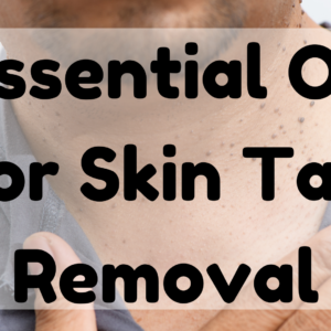 Essential Oil for Skin Tag Removal