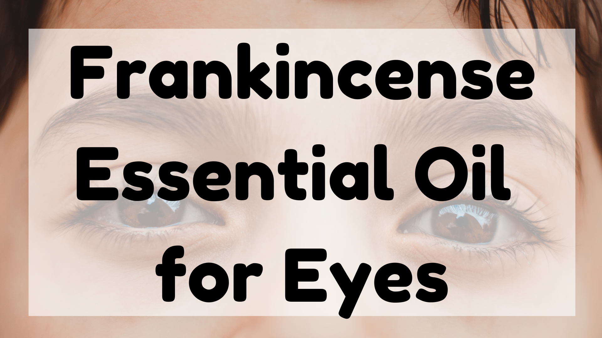 Frankincense Essential Oil For Eyes