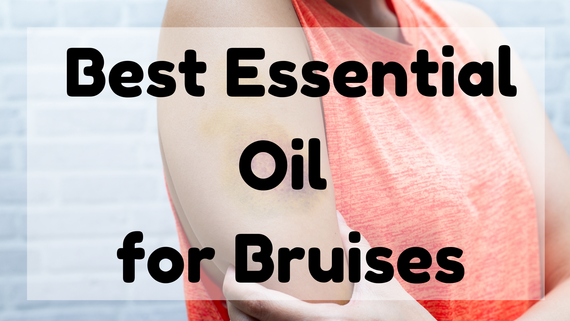 Best Essential Oil For Bruises