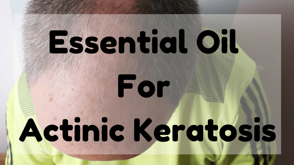 Essential Oil for Actinic Keratosis