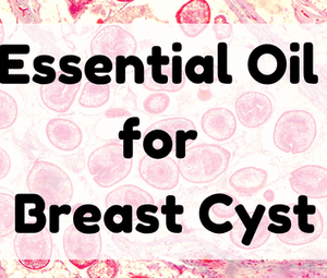 Essential Oil for Breast Cyst