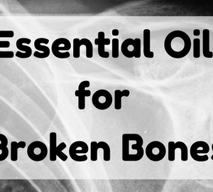 Essential Oil for Broken Bones