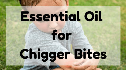 Essential Oil for Chigger Bites