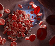 blood having clot (1) (Essential Oil For Blood Clots)