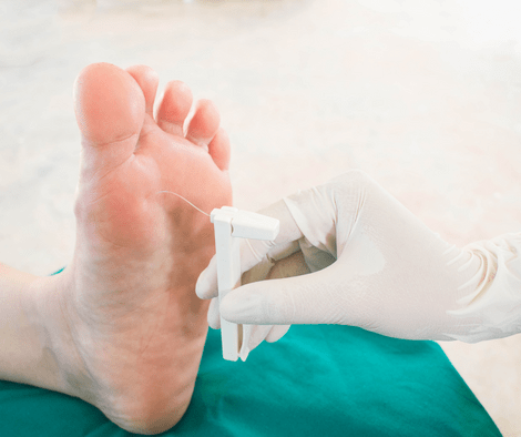 neuropathy in feet (Essential Oil For Neuropathy in Feet)