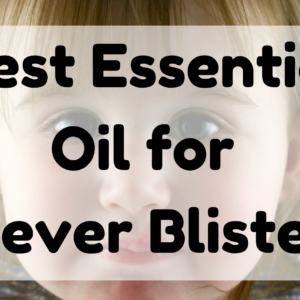 Best Essential Oil for Fever Blister featured image