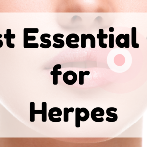 Best Essential Oil for herpes featured image