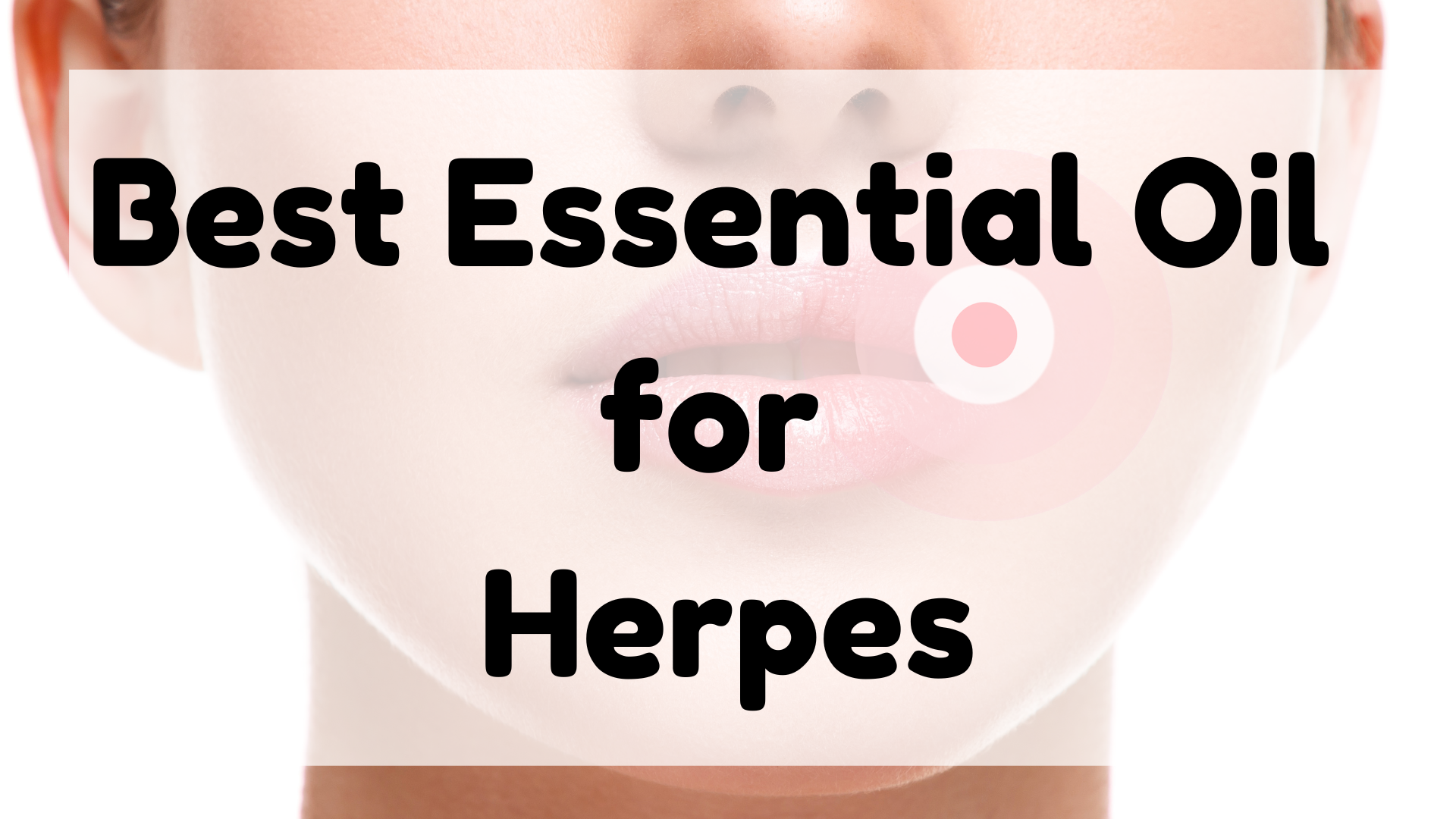 Best Essential Oil for herpes featured image