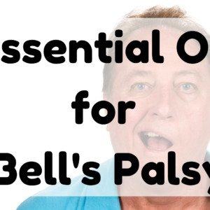 Essential Oil for Bell's Palsy featured image