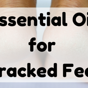 Essential Oil for Cracked Feet featured image