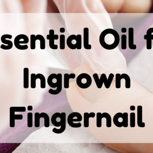 Essential Oil for Ingrown Fingernail featured image