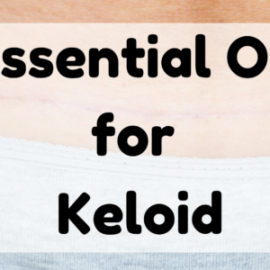 Essential Oil for Keloid featured image