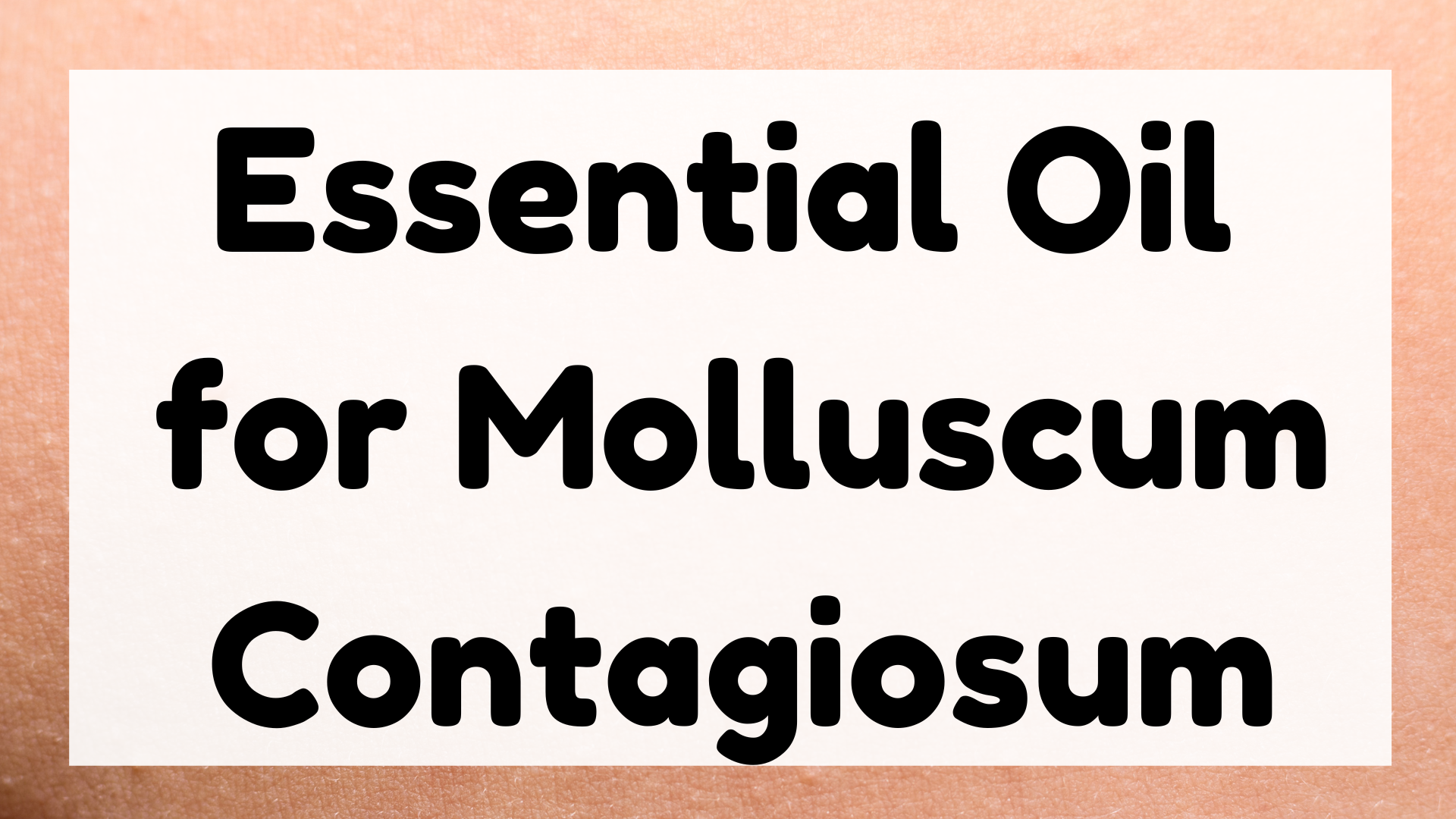 Essential Oil for Molluscum Contagiosum featured image