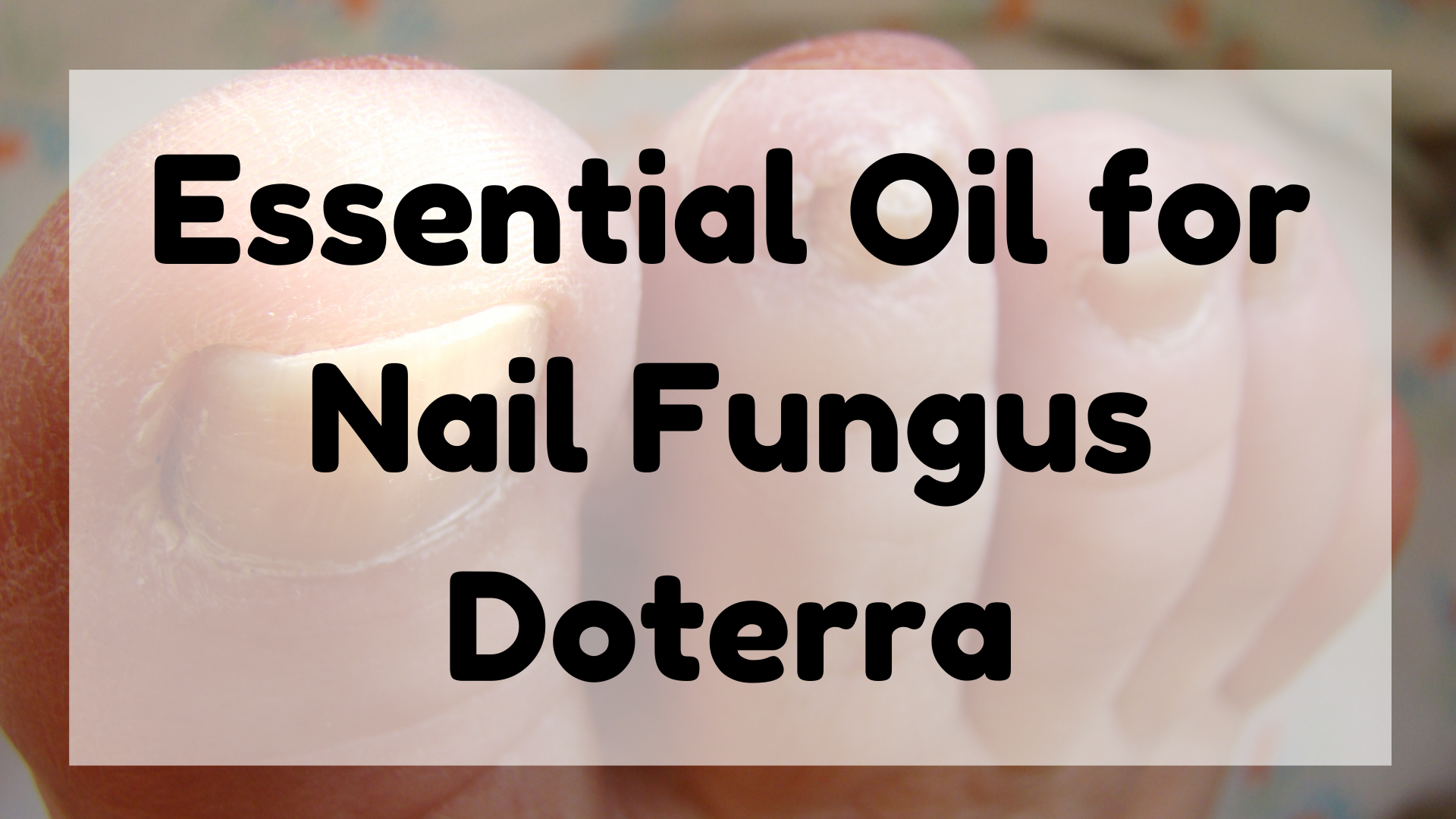 Essential Oil for Nail Fungus Doterra featured image