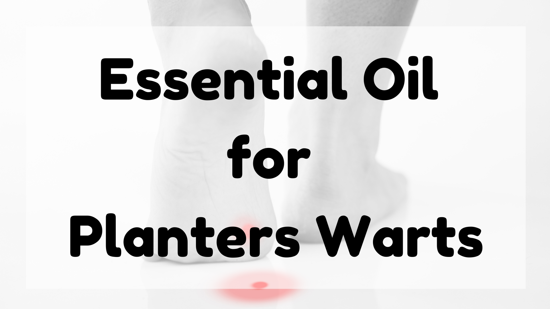Essential Oil for Planters Warts featured image