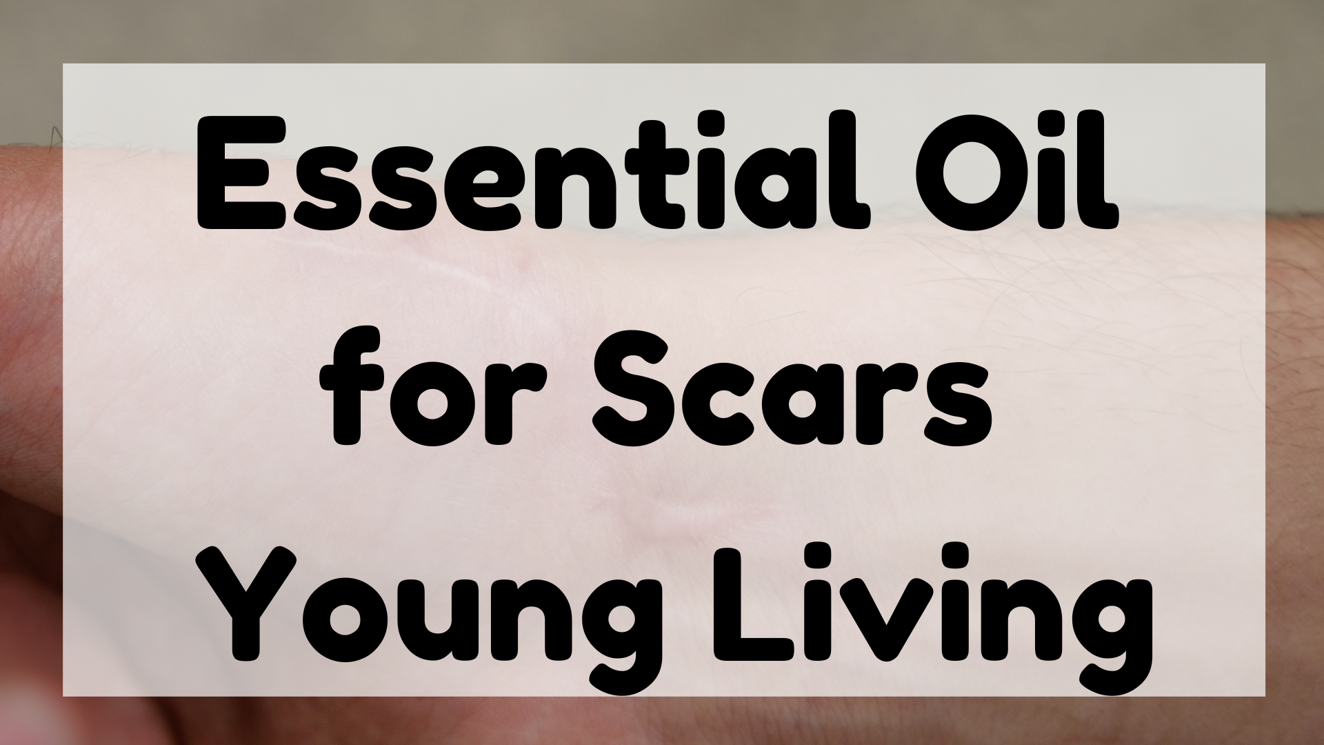 Essential Oil for Scars Young Living featured image