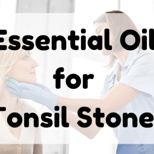 Essential Oil for Tonsil Stones featured image