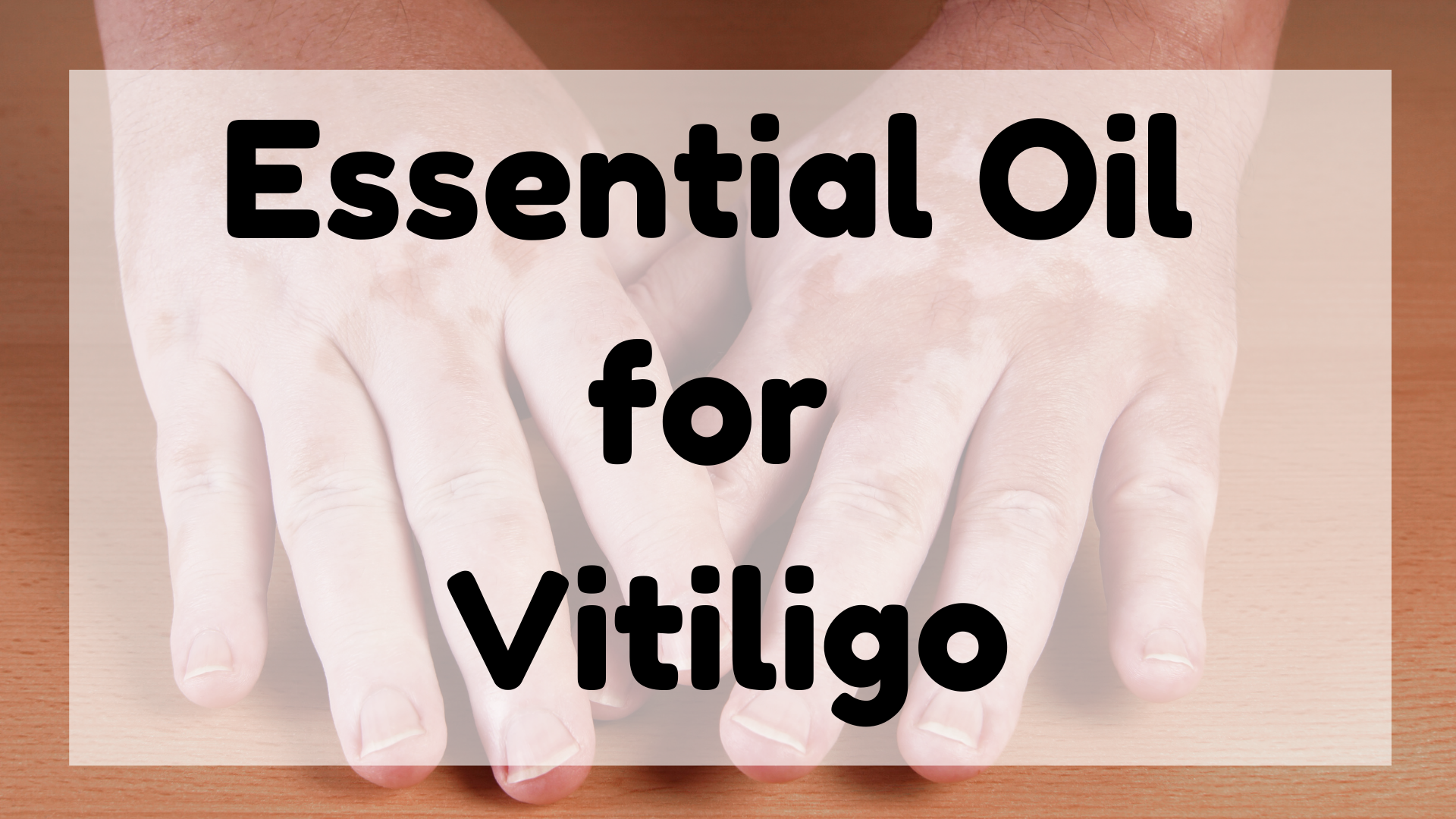 Essential Oil for Vitiligo featured image