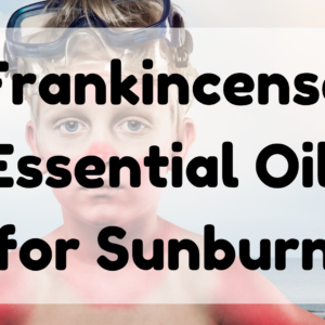Frankincense Essential Oil for Sunburn featured image
