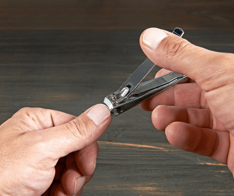 cutting ingrown fingernails