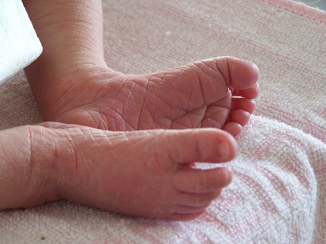 dry feet of baby
