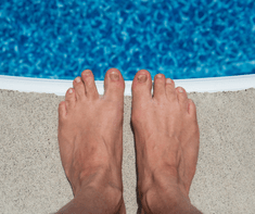 pair of feet with toenail fungus