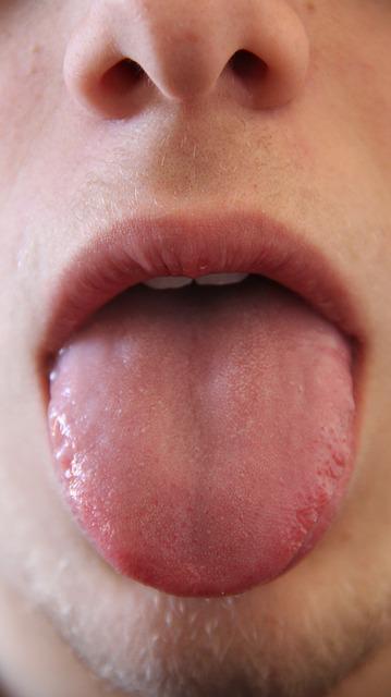tongue sore