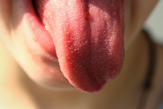 woman with tongue sore