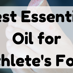Best Essential Oil for Athlete's Foot featured image