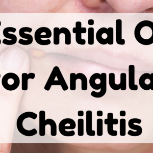 Essential Oil for Angular Cheilitis featured image