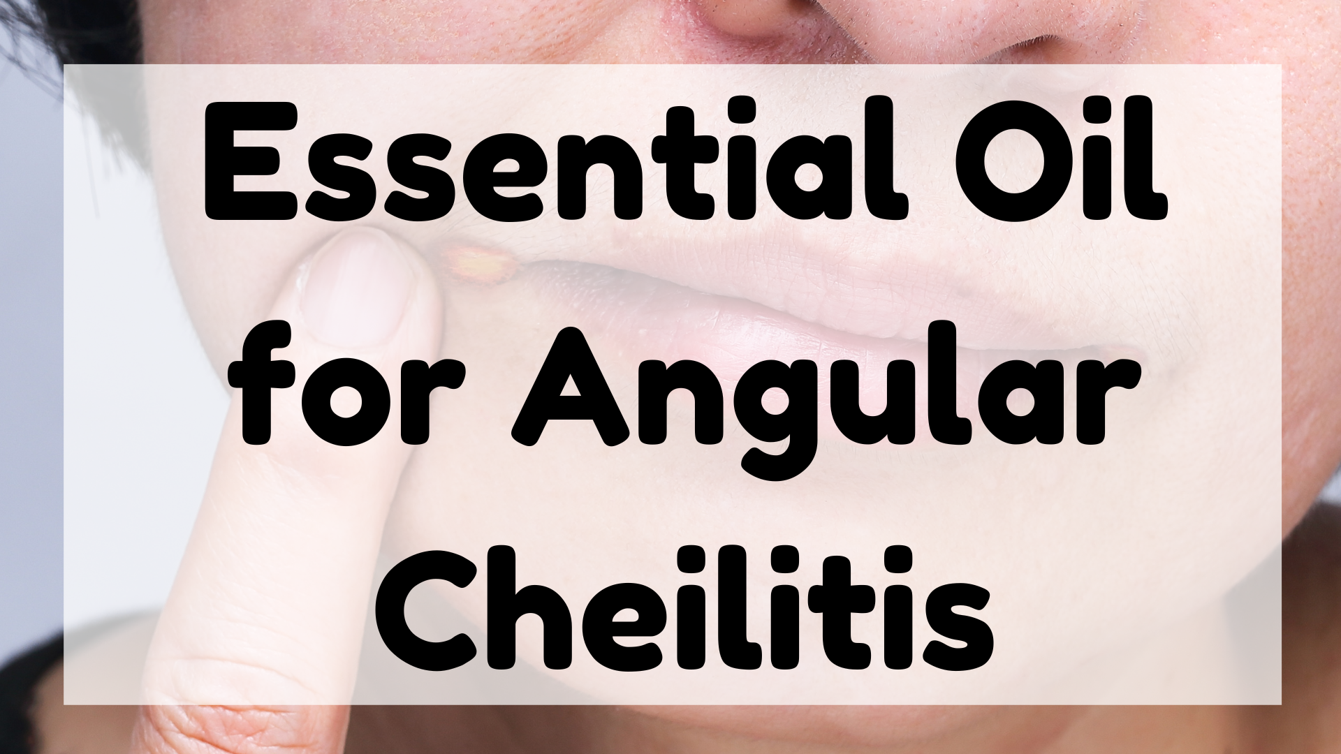 Essential Oil for Angular Cheilitis featured image