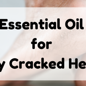 Essential Oil for Dry Cracked Heels featured image