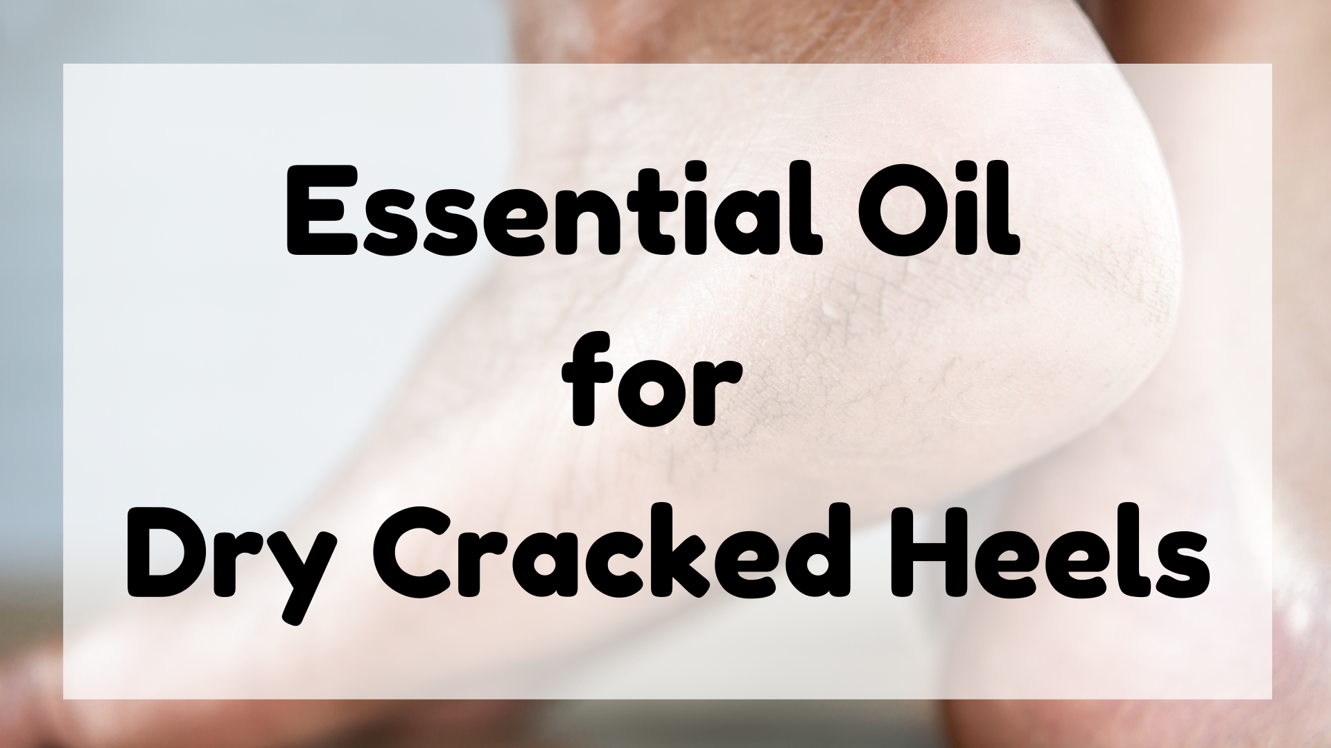 Essential Oil for Dry Cracked Heels featured image