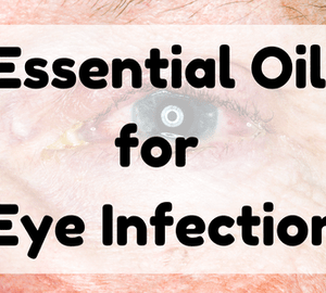 Essential Oil for Eye Infection featured image