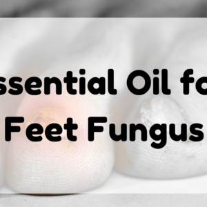 Essential Oil for Feet Fungus featured image