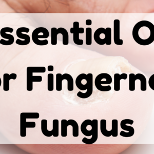 Essential Oil for Fingernail Fungus featured image