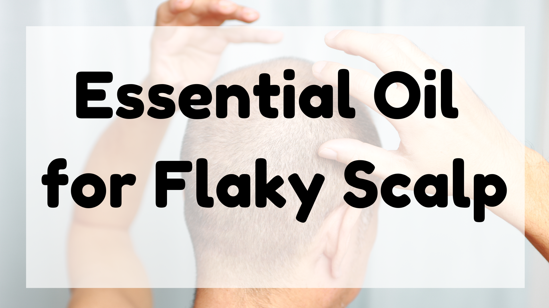 Essential Oil for Flaky Scalp featured image